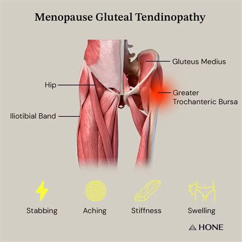 Gluteal Tendinopathy Menopause