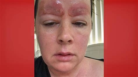 Image result for Worst Microblading