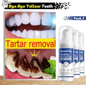 smartdrops Teeth Whitening Foam Deeply Clean Gums Intensive Stain ...