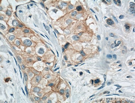 Occludin antibody (13409-1-AP) | Proteintech