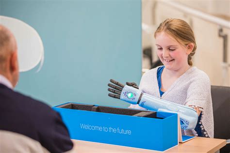 how do prosthetic arms work - Open Bionics