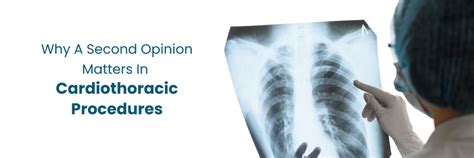 Learn How Cardiothoracic Procedures Second Opinion Matters