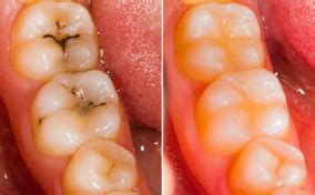 Usha dental Care
