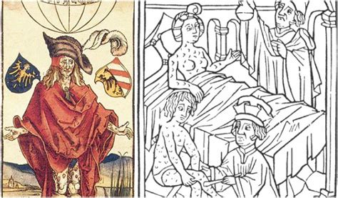 When syphilis first surfaced the English called it the "French disease ...