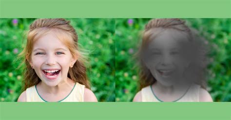 Image result for Macular Degeneration Example