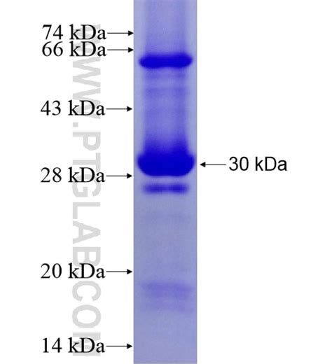 Kir6.2 Fusion Protein Ag10368 | Proteintech