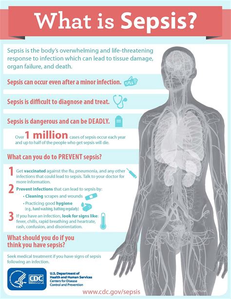 Sepsis Symptoms