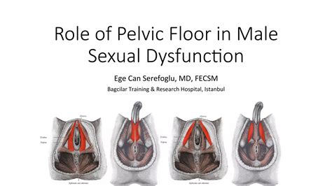 Role of pelvic floor in male sexual dysfunction | PDF
