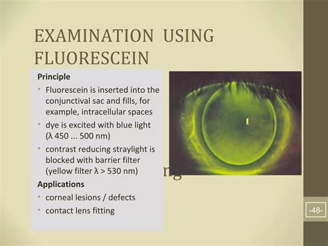 Image result for Slit Lamp Exam Tutorial