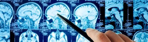 Assessment of clinical evaluation reports for medical devices | TÜV SÜD ...