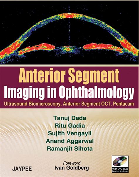 Buy Anterior Segment Imaging in Ophthalmology with DVD-ROM Book Online ...