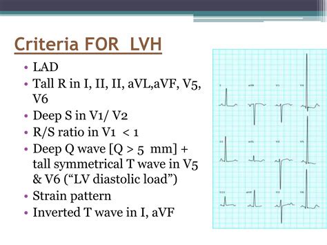 Pediatric ECG final.pptx