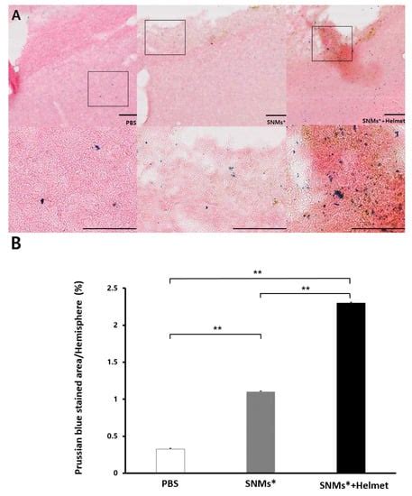 Targeted Delivery of Iron Oxide Nanoparticle-Loaded Human Embryonic ...