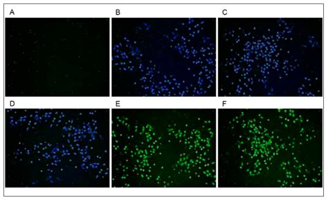 African Swine Fever Virus R238L and R298L Disrupt Lung Cell Collagen ...