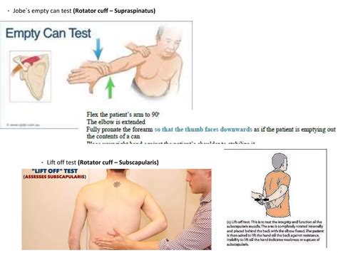 Shoulder Examination | PPTX