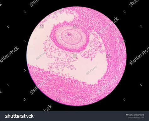 Graafian Follicle Histology