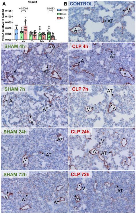 Heterogeneous Patterns of Endothelial NF-κB p65 and MAPK c-Jun ...