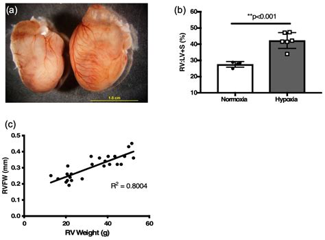 Echocardiographic Assessment of Pulmonary Hemodynamics and Right ...