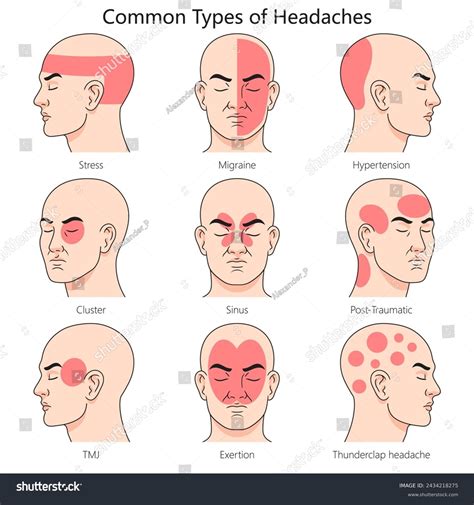 Tipos De Clavos: Over 178,165 Royalty-Free Licensable Stock Illustrations & Drawings | Shutterstock