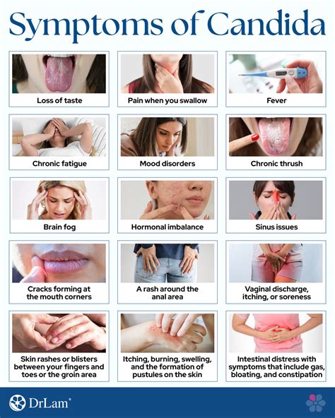 Candida Symptoms Can Candida Affect The Thyroid? Dr Becky Campbell