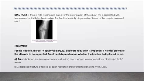 Injuries around Elbow Joint power point.pptx