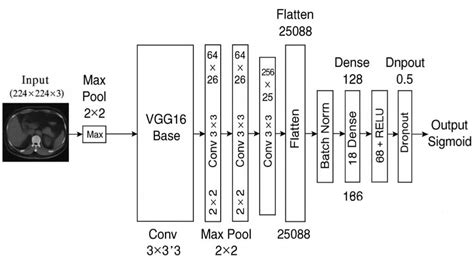 Enhanced VGG16 Model for Kidney Tumor Classification[v1] | Preprints.org