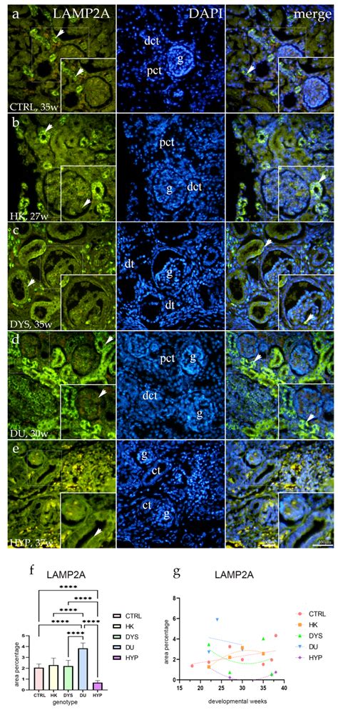 Immunoexpression Pattern of Autophagy-Related Proteins in Human ...