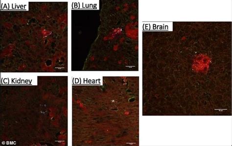 Plastic Nanoparticles Can Pass From Pregnant Mother To Foetus, Finds ...