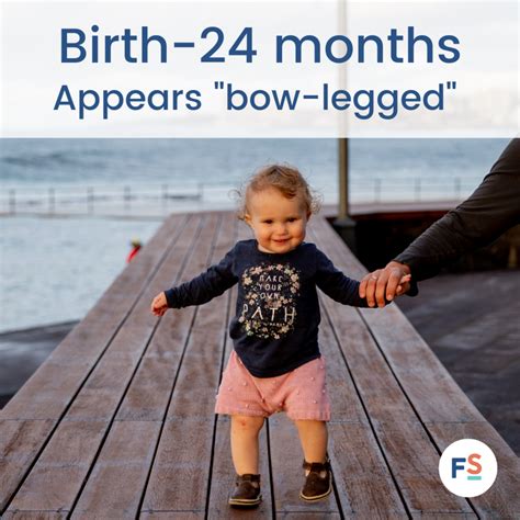 Image result for Normal Leg Alignment