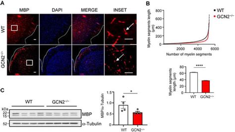 GCN2-Mediated eIF2α Phosphorylation Is Required for Central Nervous ...