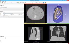 Image result for Python Volume Slicer