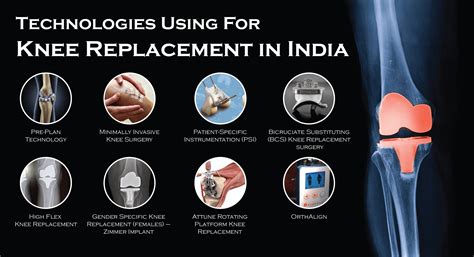 What Are The Diffe Types Of Total Knee Replacements - Infoupdate.org