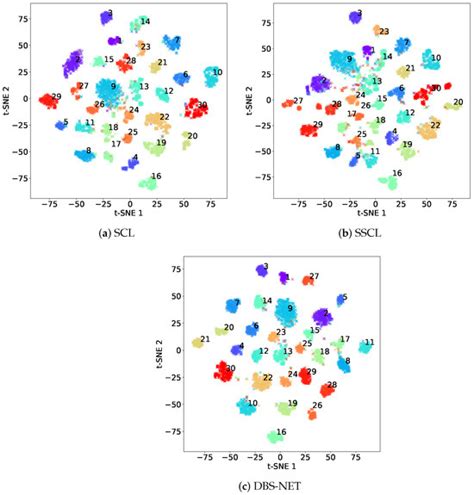 DBS-NET: A Dual-Branch Network Integrating Supervised and Contrastive ...