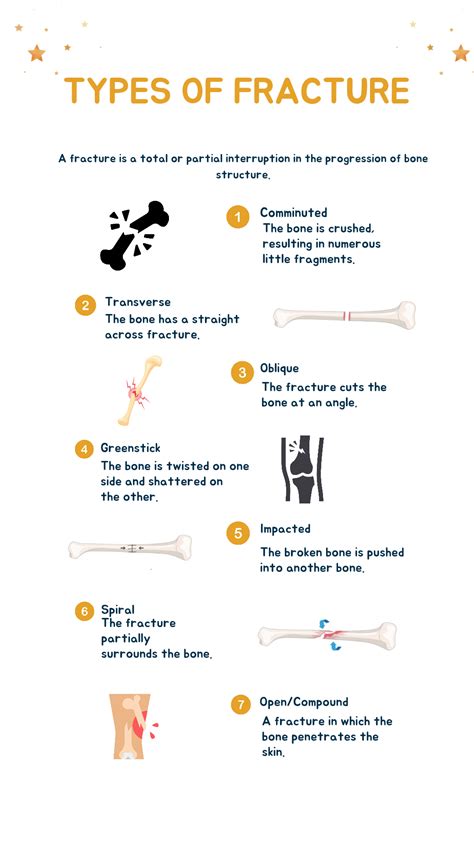 Types of Bone Fractures - StudyPK | Types of bones, Bone fracture, Fractures