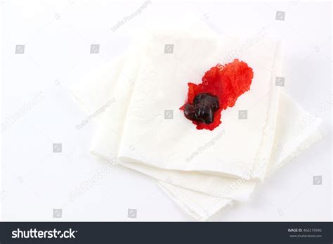 Pinkish Blood On Toilet Paper