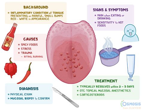 Transient Lingual Papillitis Lie Bumps on Tongue | Osmosis