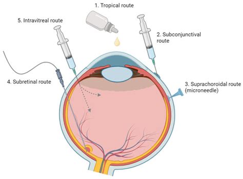 Subconjunctival Injection 的图像结果