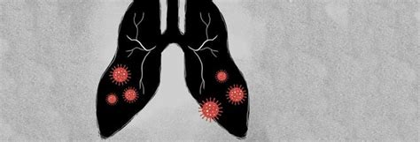 Africa's non-communicable disease burden likely to worsen without ...