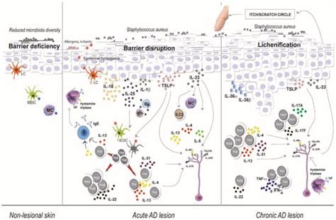 Multiple Roles for Cytokines in Atopic Dermatitis: From Pathogenic ...