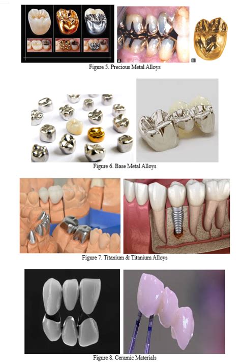 Advancements in Dental Casting Materials & Their Forensic Significance