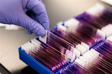 Image result for Lab MLT