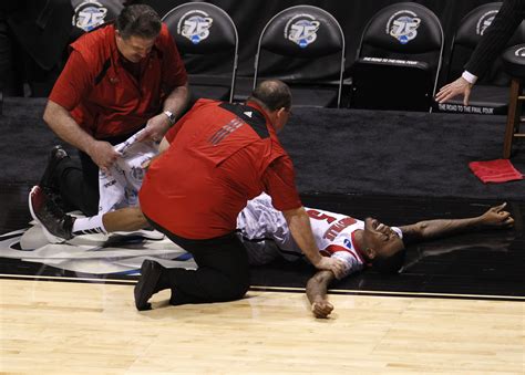 Kevin Ware Injury Close Up In Hospital