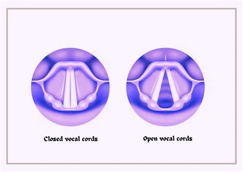 Vocal Fry Vocal Fry In Children: Is It A Sign Of A Larger Speech