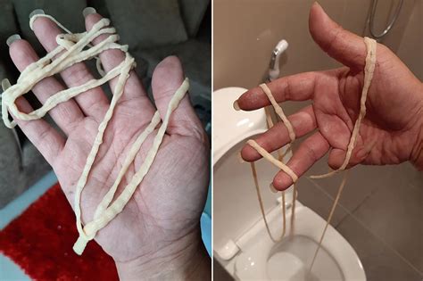 20 Facts About What Do Tapeworms Look Like - Facts.net