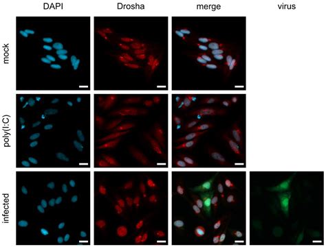 Oncolytic Measles Virus Encoding MicroRNA for Targeted RNA Interference