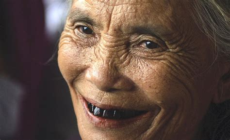 Image result for Stumpy Black Teeth