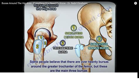 How Do You Sleep Comfortably With Hip Bursitis at Troy Haynes blog