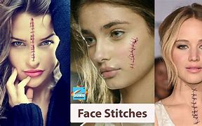 Image result for face stitcher