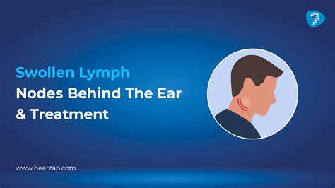 Swollen Lymph Nodes Behind Ear - Hearzap