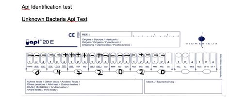 Image result for API Identification Bacteria Expensive